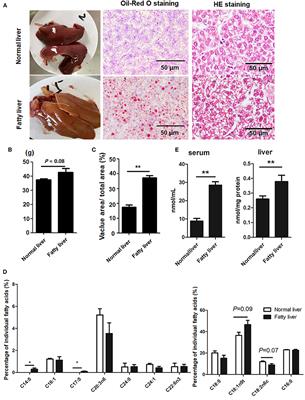 The miR-216/miR-217 Cluster Regulates Lipid Metabolism in Laying Hens With Fatty Liver Syndrome via PPAR/SREBP Signaling Pathway